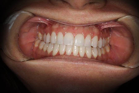orthodontics after