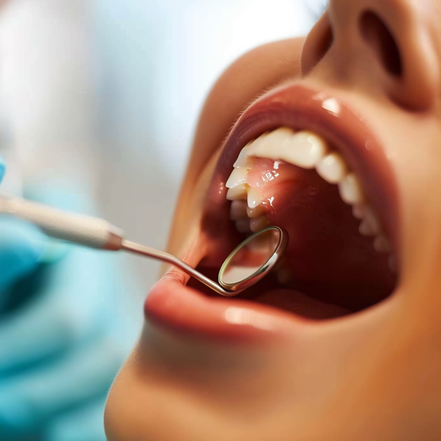 Dentist examining a patient's mouth during an oral cancer screening in Rapid City, SD